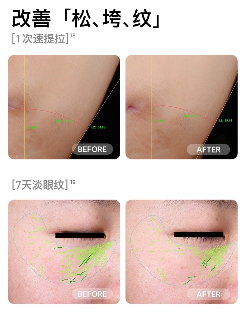 【品牌国内同价】FLOSSOM花至 小紫弹智能射频美容仪器 家用智能美容仪 多功能分区护理 脸部&颈部提拉紧致 速渗透 强透亮FR200 1 件