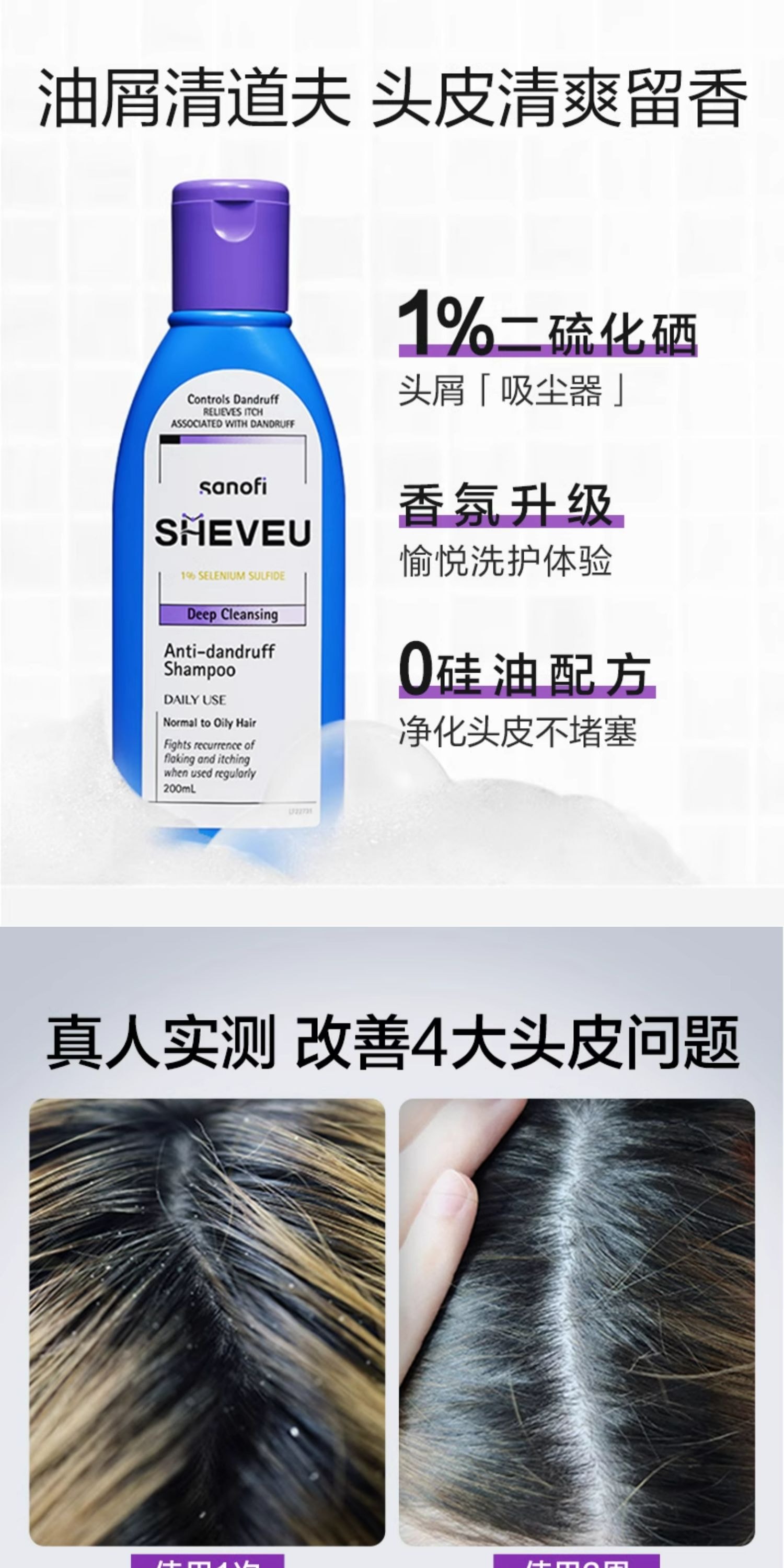 【中国直邮】 澳大利亚 赛逸 二硫化硒去屑控油蓬松氨基酸洗发水 控油去屑紫瓶200ml/瓶