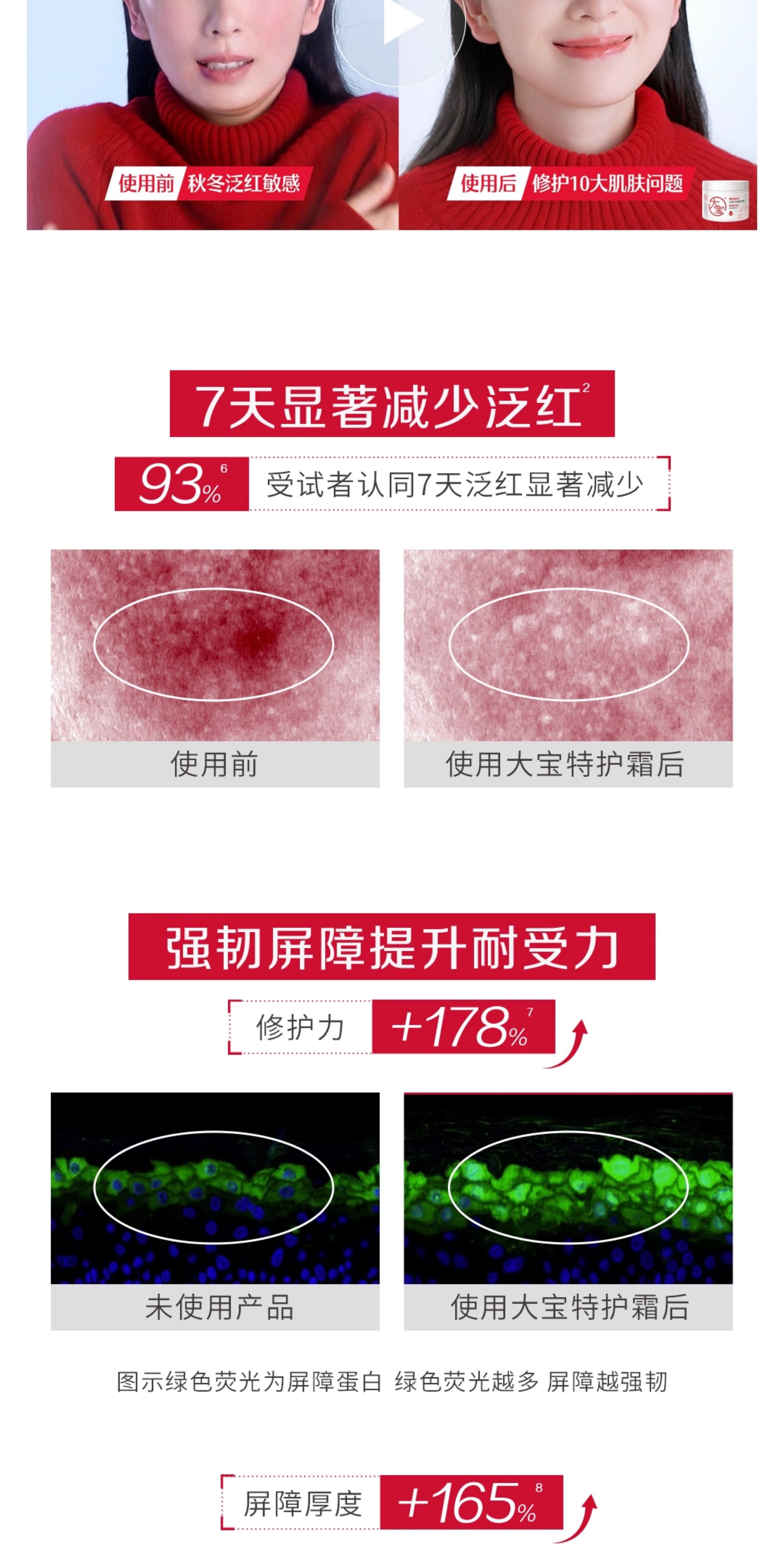 【中国直邮】 大宝 维他命B5面霜 安敏舒缓特护霜 保湿修护【李佳琦强推必入】70g*1罐