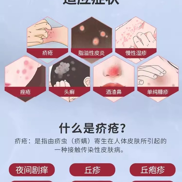 [중국 직배송] 천시 10% 유황 연고 - 진드기 및 가려움 완화, 지루성 피부염, 습진, 여드름에 효과적입니다. 20g/박스 (소홍수 사용자 추천) 4