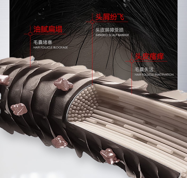 【中国直邮】 新加坡 Kuvive 毛囊净澈洗发水 二硫化硒洗发水毛囊除炎螨去屑止痒控油蓬松洗头膏露男女正品 500ml/瓶