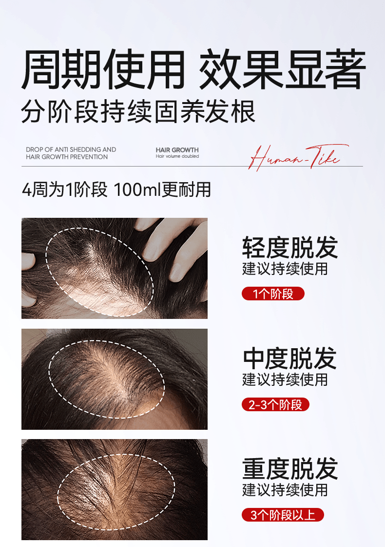 【中国直邮】 新加坡 Kuvive 生姜育发液 生长发增发密发头皮精华液头发护理剂发际线快速长 100ml/瓶