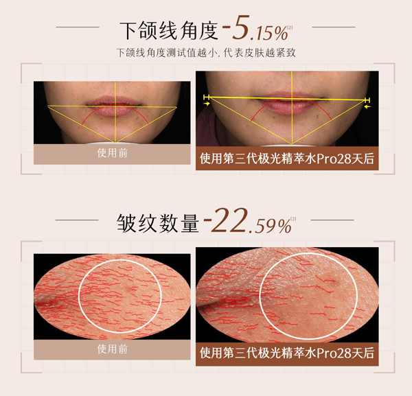 谷雨 【抗皱专研-水乳套组】山参抗衰淡斑水乳套装【美白祛斑特证】【淘宝TOP1淡斑面部护理】【更适合亚裔肤质】(第三代极光精萃水Pro 120ml+第三代山参胶原乳Pro 100ml)
