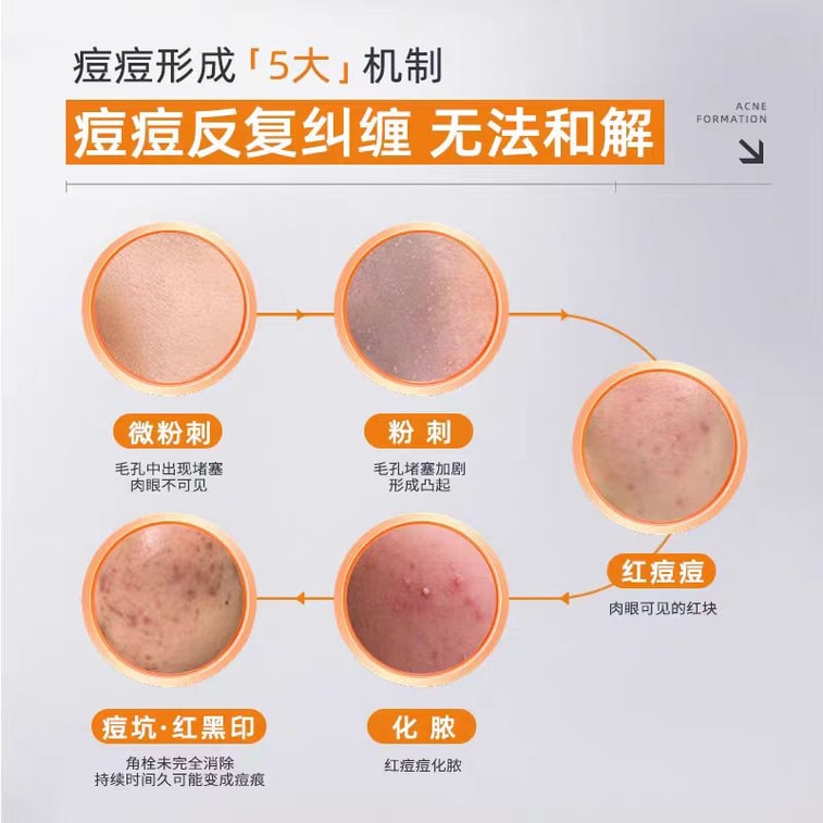 【中国直邮】  片仔癀 祛痘修护膏 修复淡化痘印凝胶9g*1支 3