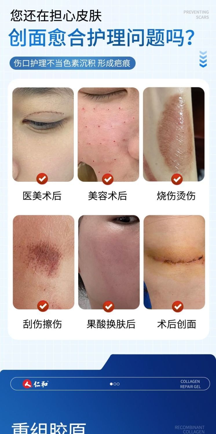 仁和 醫用級重組三型人源化膠原蛋白修護凝膠15g 預防疤痕 減輕色素沉著