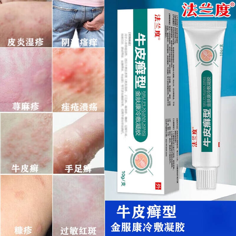 【中国直邮】 法兰度 牛皮癣型冷敷凝胶 适用于皮炎湿疹 手足癣 荨麻疹 糠疹 过敏红斑 痤疮溃疡 阴部瘙痒 10g/支