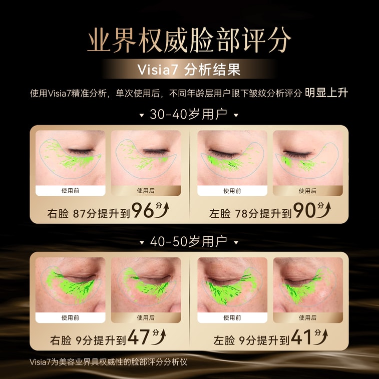 虧本清倉 贈金箔水潤凝膠【演員及國際中華小姐冠軍張曦雯代言】中國香港 paige 珮肌美容儀24K黃金電極頭玉如意射頻儀家用抗初老美容儀 粉紅色 1件 11