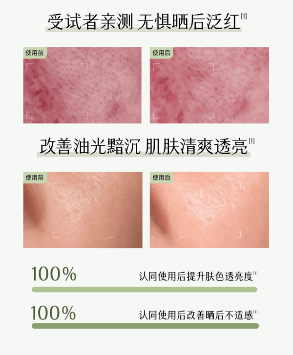  穀雨 [囤貨裝2盒] 白千松露 冰繃帶 貼片面膜【控油平衡】【冰感舒緩】【曬後修護】 舒緩泛紅 補水控油 保濕面膜 28ml*5片 / 一盒