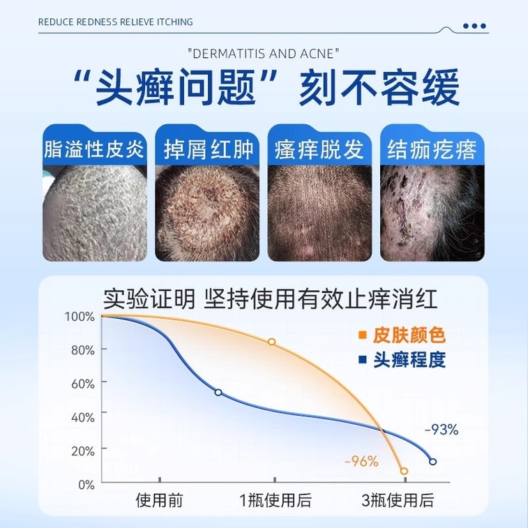 【中国からの直送】フケ、脂漏性皮膚炎、真菌感染症の治療薬、非薬物軟膏、頭皮乾癬、かゆみ、毛包炎の治療、カルボマー保湿皮膚ドレッシング 20ml 3