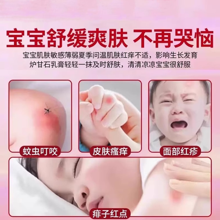 祥医堂 炉甘石软膏 皮肤湿疹婴儿专用止痒抑菌去乳膏20g/盒 3
