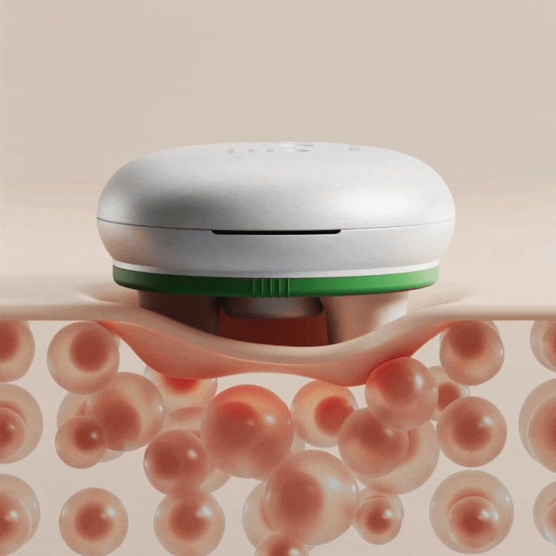 【中国直邮】 MEDISANA 揉腹仪 全自动按摩加热敷肚子促进肠胃蠕动-通便揉腹胀  一个装