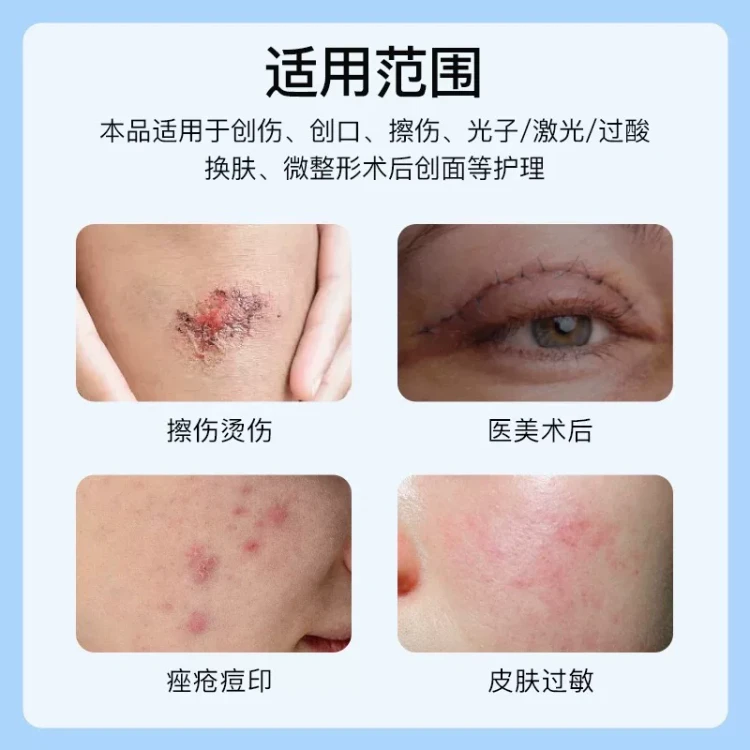XIUZHENG 修正 医用重组三型人源化胶原蛋白修护凝胶15g 减轻色素沉着