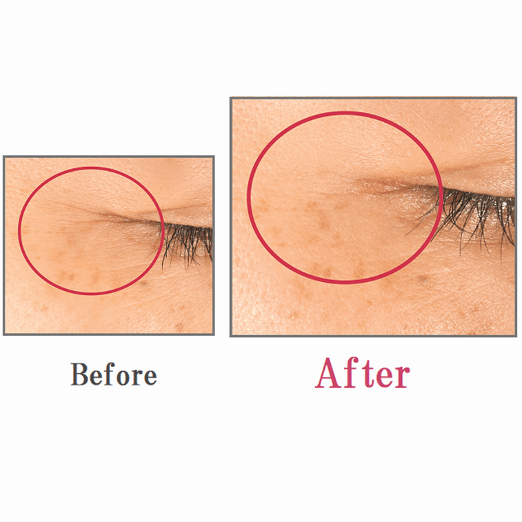 COVERMARK||보습 주름개선 아이크림||20g 4