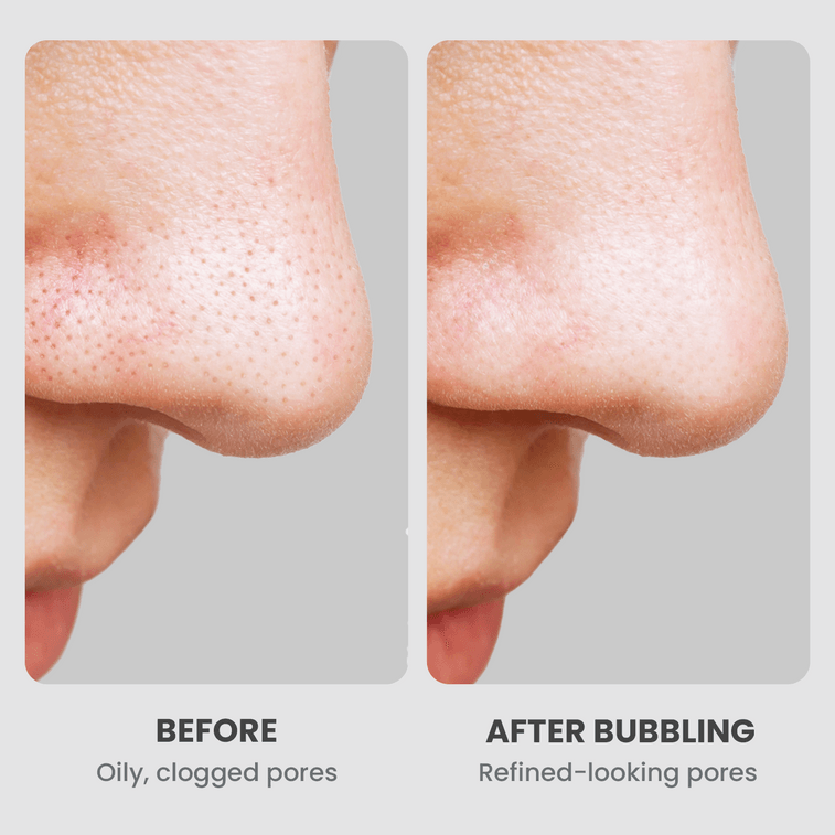 GLAM UP クレンジングバブル炭酸泥マスク（フェイシャル浄化）135ml（4.56オンス）韓国製 3