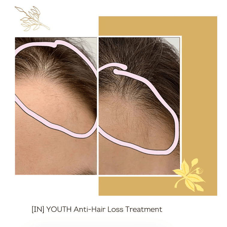 【歐洲直郵】 法國 馥洛薇 小橙針 止脫育發角蛋白 10支/盒 4