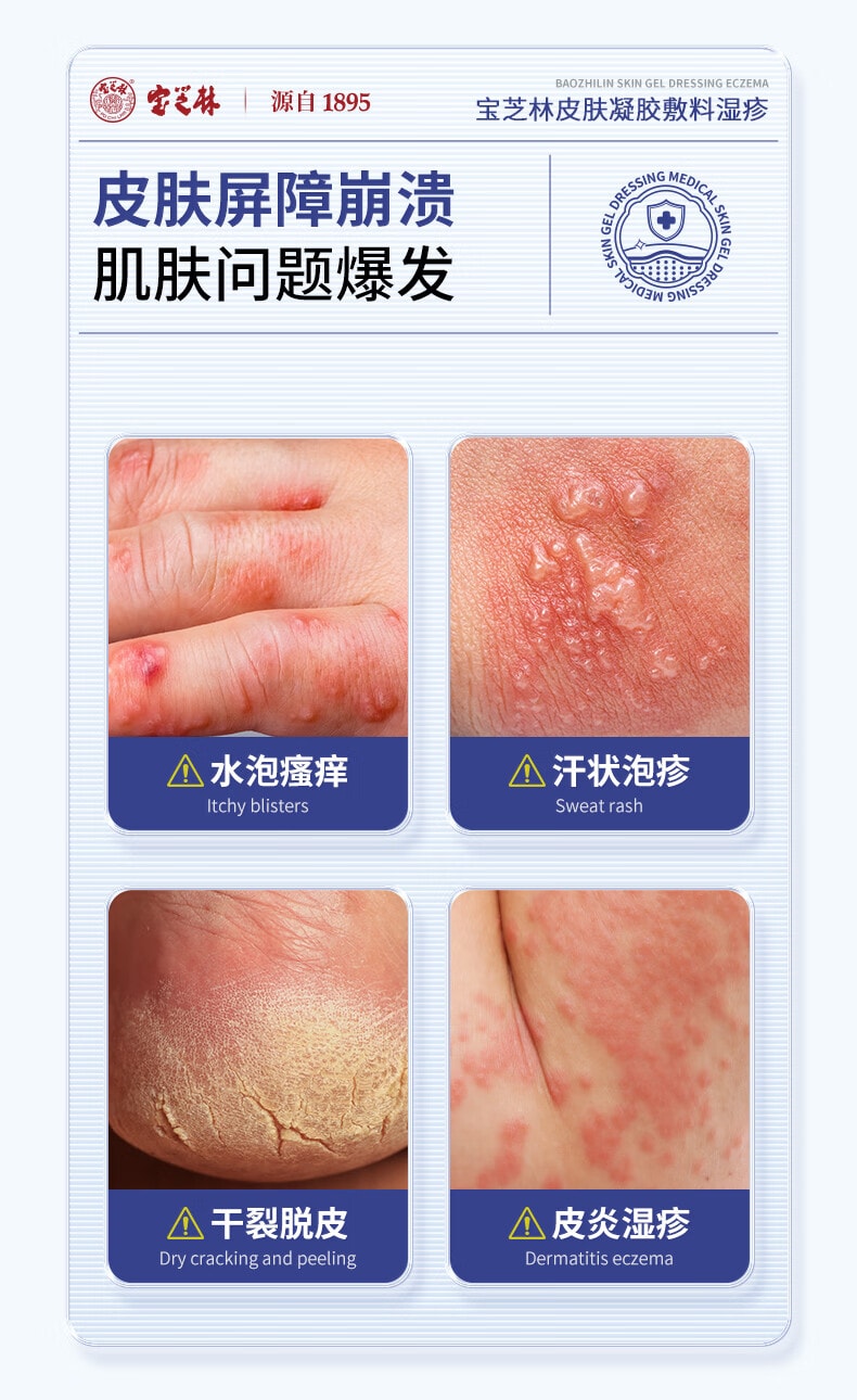 宝芝林 【双重黄金配方 0激素长效抑菌防护】湿疹膏20g 止痒药膏止痒去汗疱疹根除阴囊潮湿肛门瘙痒止痒 小儿皮炎湿疹【快速舒缓止痒,深层形成防护屏障】专利成分16倍湿性愈合
