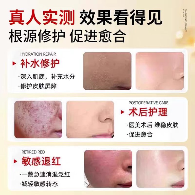 Recombinant Type III Humanized Collagen Dressing 20g Skin care recovery 7