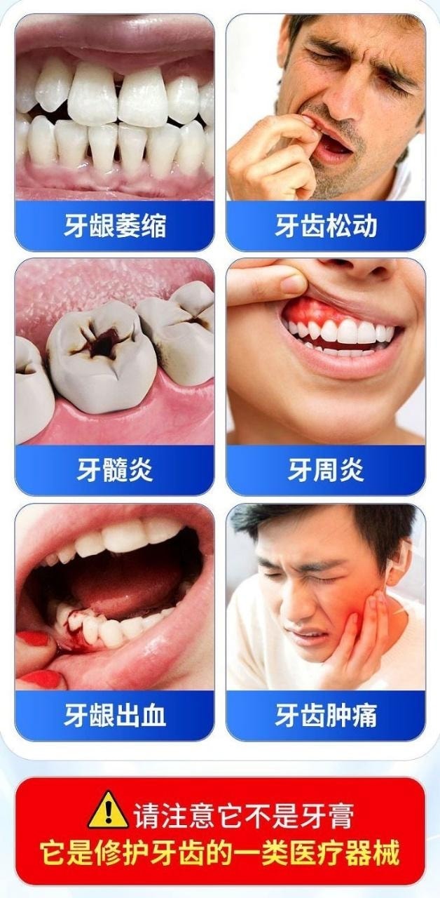 【中國直郵】 北京同仁堂 內廷上用 口腔脫敏膏 治療牙齒過敏牙周炎牙齦出血炎症牙菌斑 90g/支