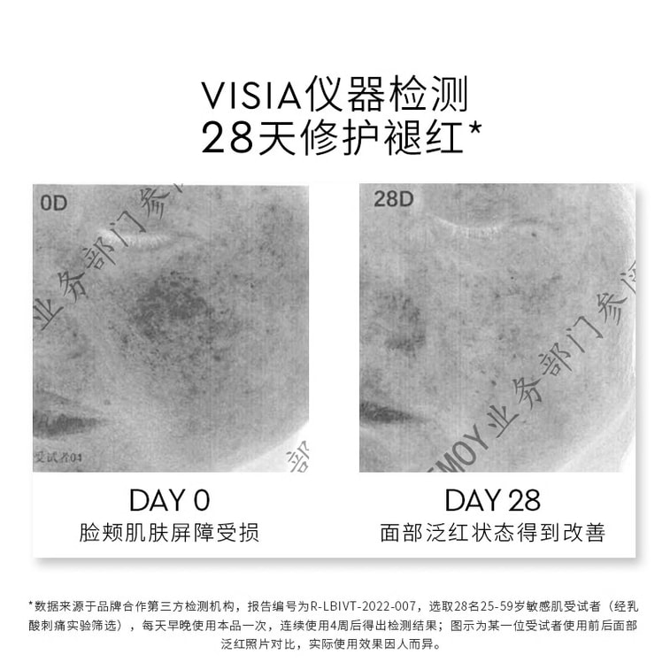【中国直送】オーストラリアcemoy プラチナ ルーメン エッセンス ウォーター 敏感肌の修復、鎮静、保湿、保湿 120ml/ボトル (敏感肌専用) 3