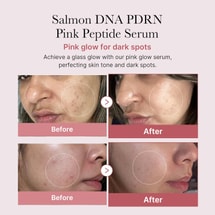 Salmon DNA PDRN Pink Peptide Serum 30ml