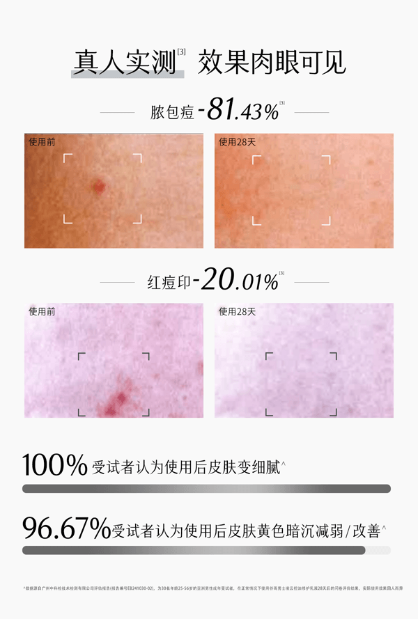 穀雨 男士乳液 補水保濕控油【國人男士專研】 【痘印-20.01%】 春夏季修護 潤膚乳 60ml