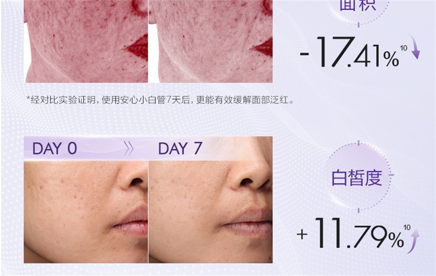 【中国直邮】 欧诗漫 珍白因安心小白管舒缓美白面部次抛精华祛斑淡斑温和敏感肌 30支/盒