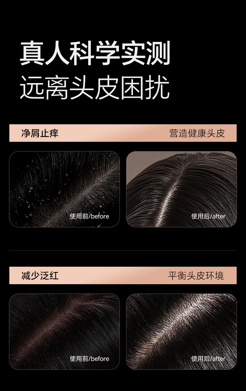 【中国直邮】 和草集 去屑控油洗发水 蓬松止痒改善头皮清爽不油腻 300ml/瓶