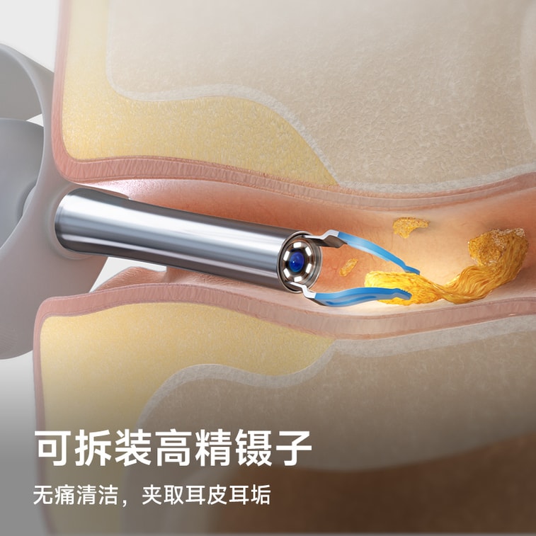 【アメリカ直送】【家族全員の耳掃除ニーズに対応】Bebird ブラックビー ハチドリ ビジュアル耳かき、高解像度耳かきピンセット、子供用耳掃除ツールセット、ダークブルー（1セット） 7