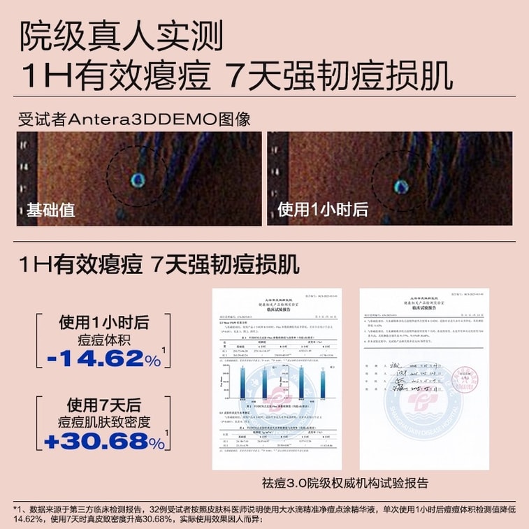 【中國直郵】 大水滴 3點祛痘精華祛痘精華液套裝10ml 5