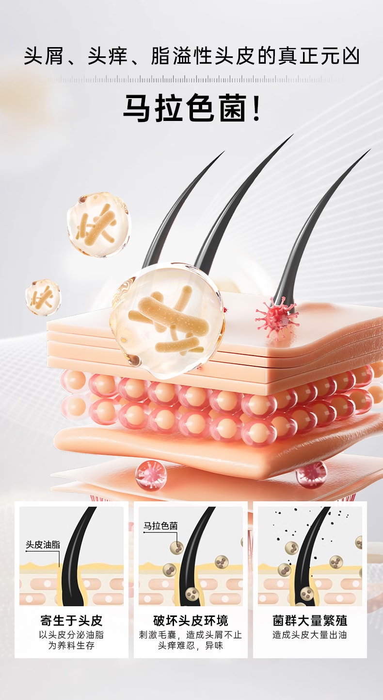 Selenium disulfide shampoo for oil control, fluffiness, dandruff removal and itch relief, salicylic acid shampoo 250ml