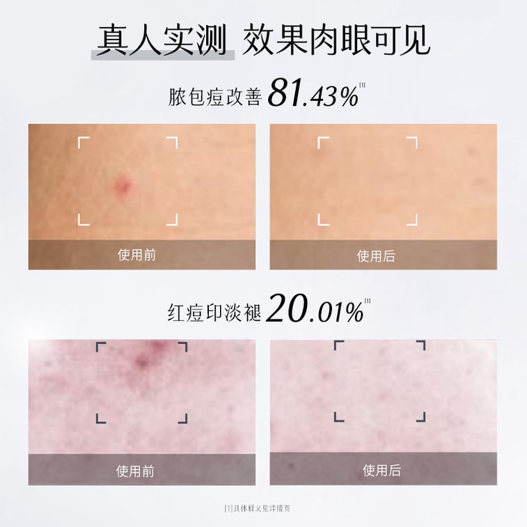 穀雨 男士乳液 補水保濕控油【國人男士專研】 【痘印-20.01%】 春夏季修護 潤膚乳 60ml 4