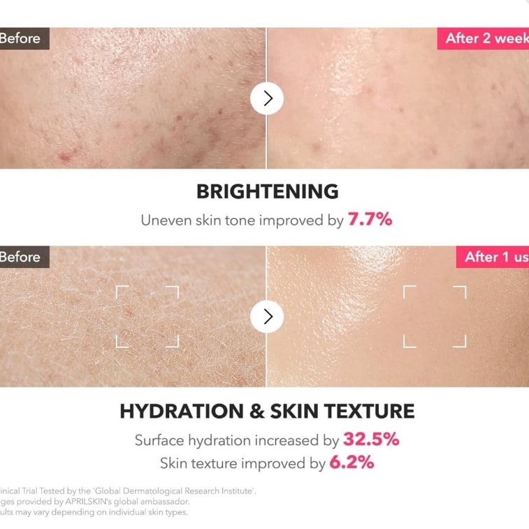 【美国直邮】韩国 aprilskin TXA Niacinamide乳液爽肤水 150ml 4