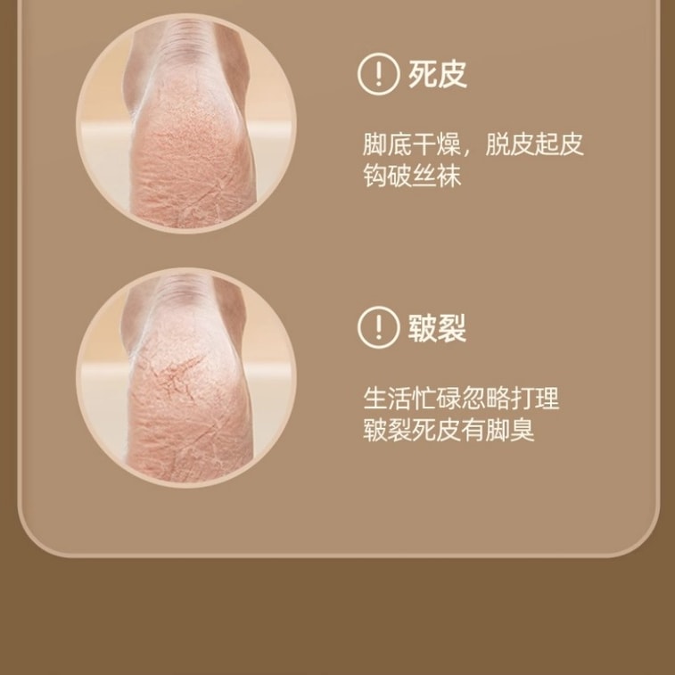 【中国直送】AUX 電動フットファイル/かかとスクラバー/角質除去器/アップグレード版（1パック） 3