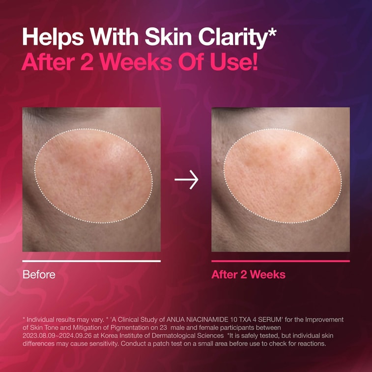 KPDH TXA Brightening Serum 50ml (50ml Serum + Charm) 6