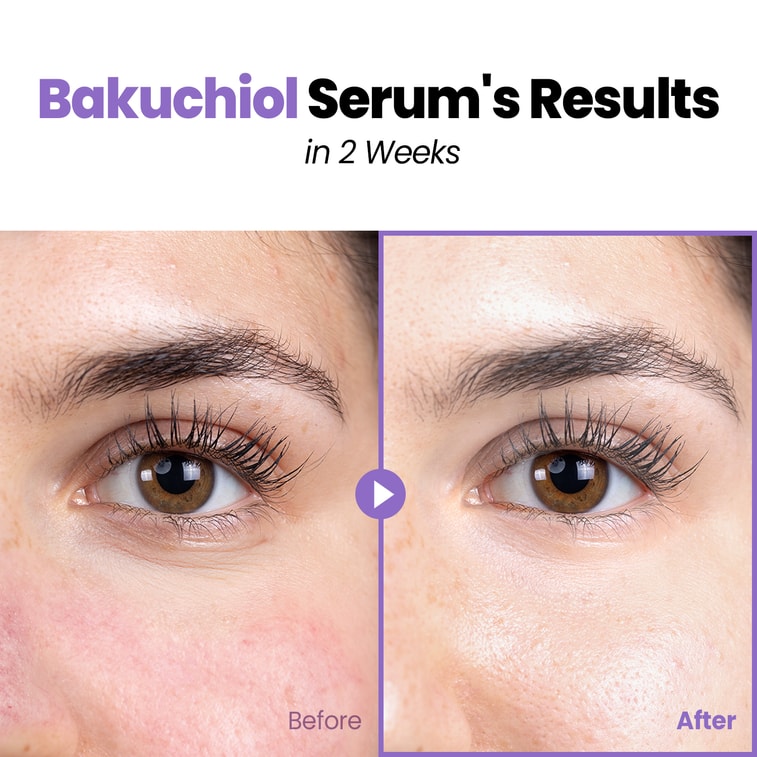 韓国の GLAM UP バクチオール エッセンス – ヒアルロン酸、アンチエイジング レチノール代替品、小じわを減らし、しわと戦い、毛穴を最小限に抑え、ニキビを鎮め、残留物なしで顔の肌に潤いを与えます (1.01 液量オンス)。 4