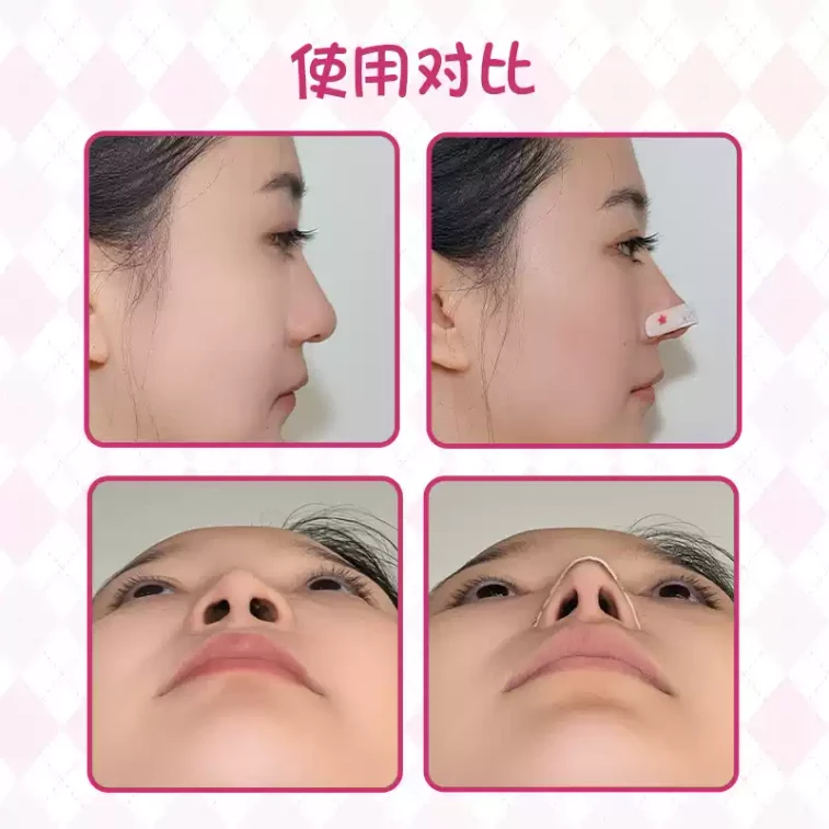 【中国直邮】 亦艾颜 可调节弯折裁剪鼻子塑形贴*1盒(30贴) 3