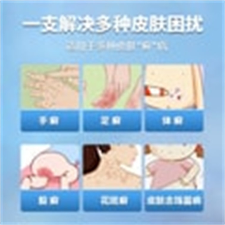 仁和 鹽酸特比萘芬乳膏 腳癬去腳氣真菌感染專用10g/支 3
