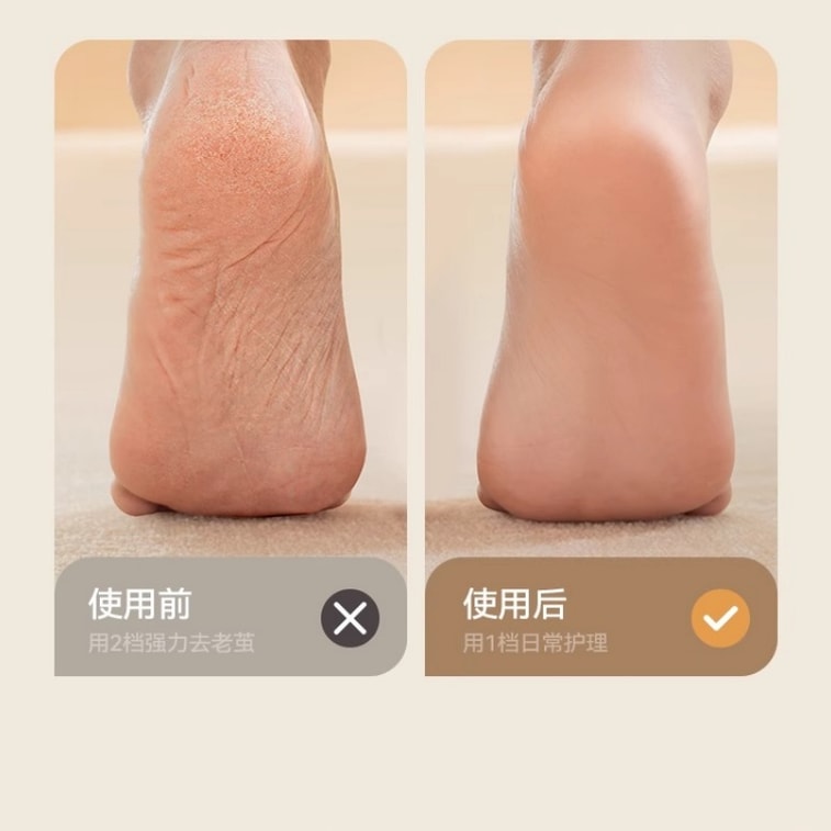 【中国直送】AUX 電動フットファイル/かかとスクラバー/角質除去器/アップグレード版（1パック） 4