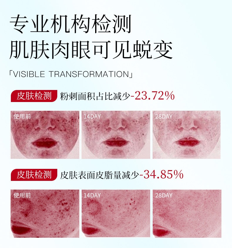 【日本直郵】 日本 LULULUN 壬二酸 控油祛痘 抑痘印 收縮毛孔 修復肌膚屏障 貼片面膜 7枚入/袋