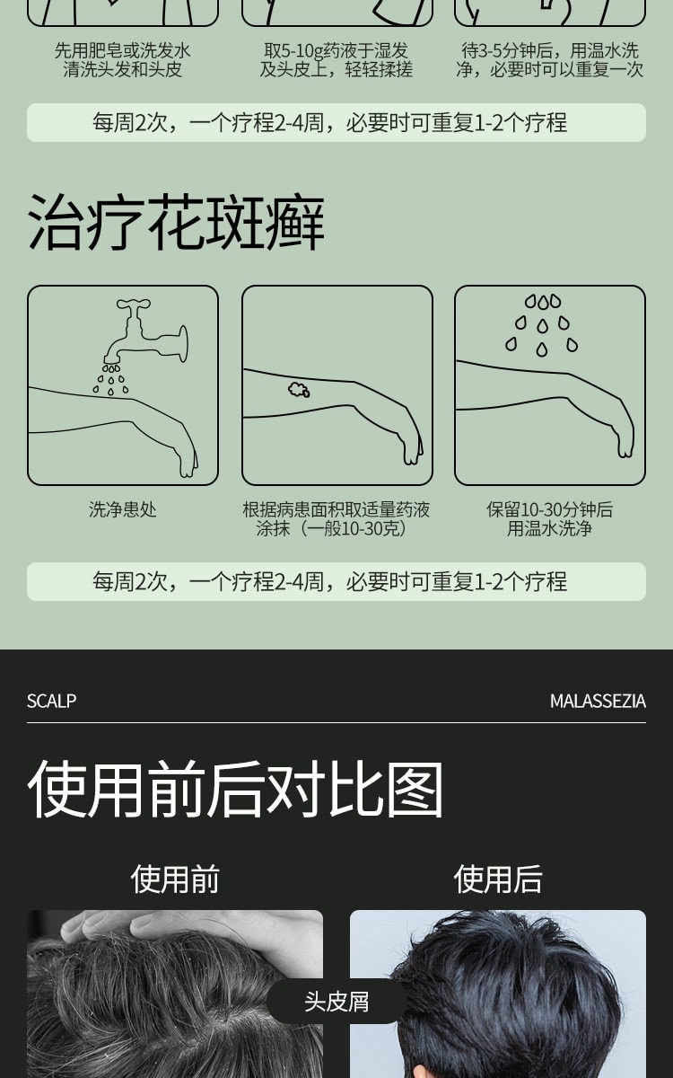 【中国直邮】 青丝几何 二硫化硒洗剂 脂溢性皮炎去屑洗发水小青瓶花斑癣汗癣止痒 120g/盒