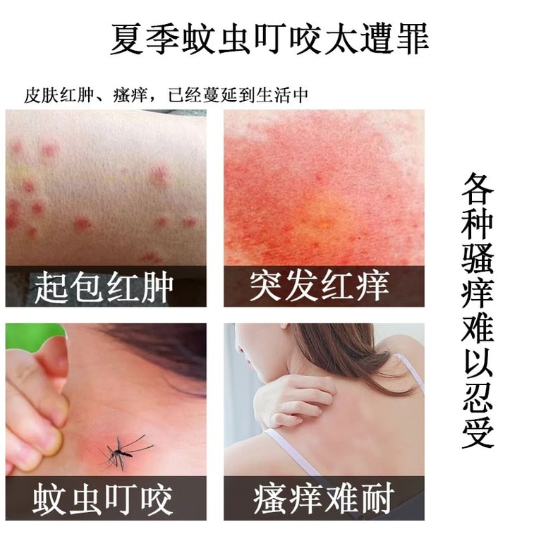 Fungus King Air Foot Cream Itch Relief Anti-bacterial Peeling Fungicide 55g 3