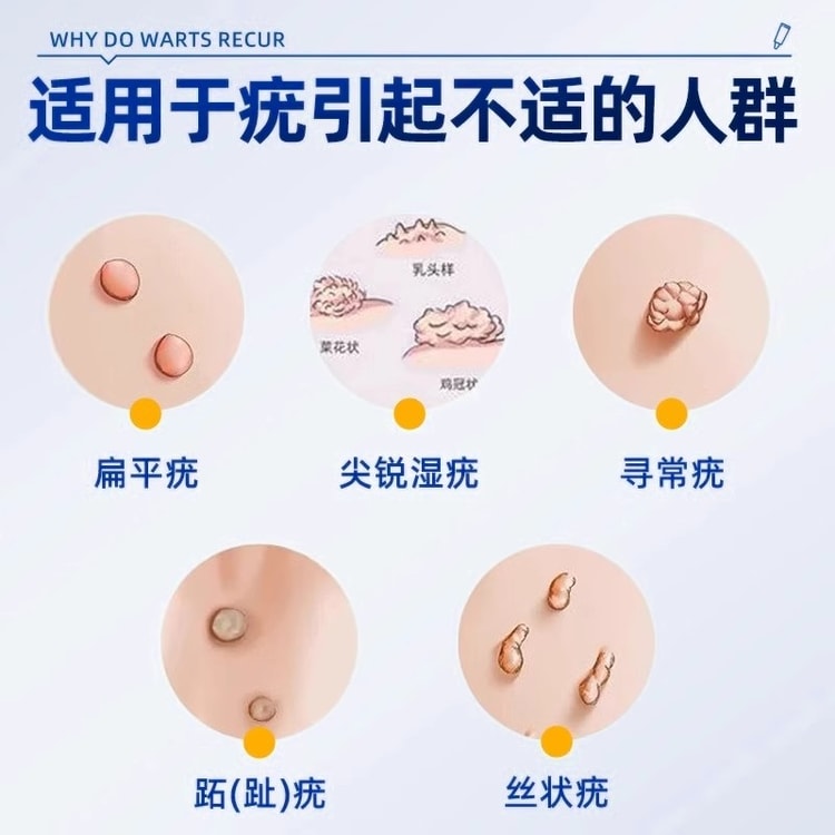KuaiYiSheng ファストドクターフラットイボ除去クリームイボや