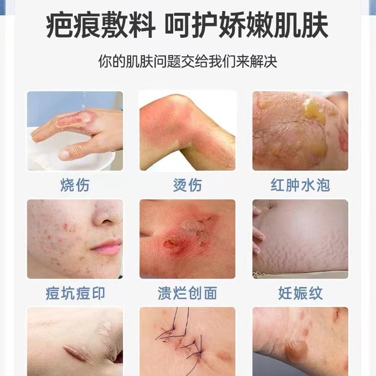 Medical Recombinant Human Epidermal Factor Type Liquid Wound Dressing Spray Type For Burn Abrasion Scar Repair 15ml/ box 3