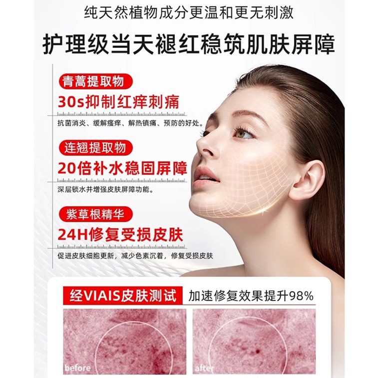 Sunburn Repair Cream for Face Neck After Sun Exposure Red Skin UV-induced Peeling Sunburn Ointment 30g/box 4