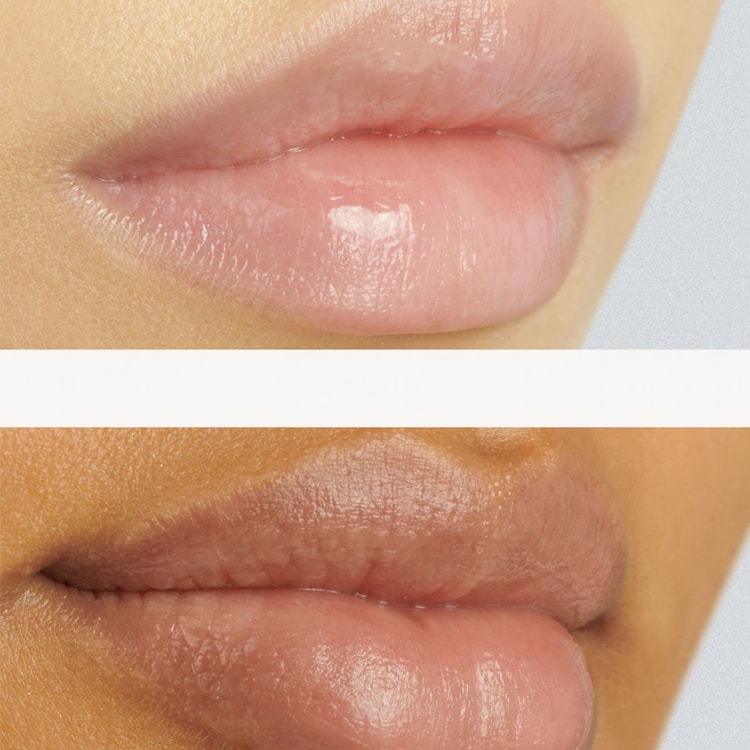 38 c 99 f lip treatment 38°C/99°F ±0 clear Single Medical Ingredient