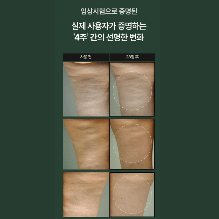 [한국 직배송] 수엘로 괄사 바디크림 120g/튜브 (한국) 5