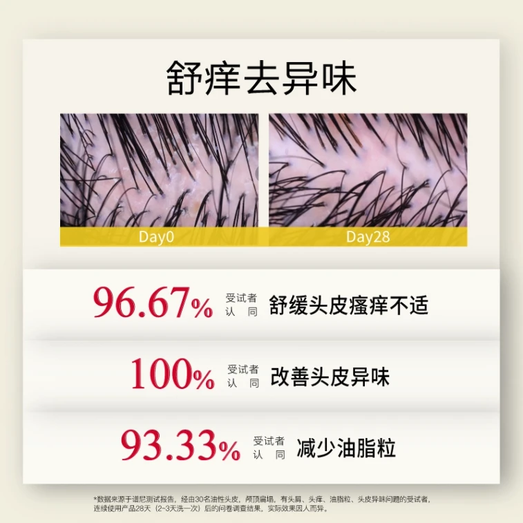 【中国直邮】 John Jeff 姜黄洗发水300g 蓬松头发 控油去屑 一次蓬松2~3天 4