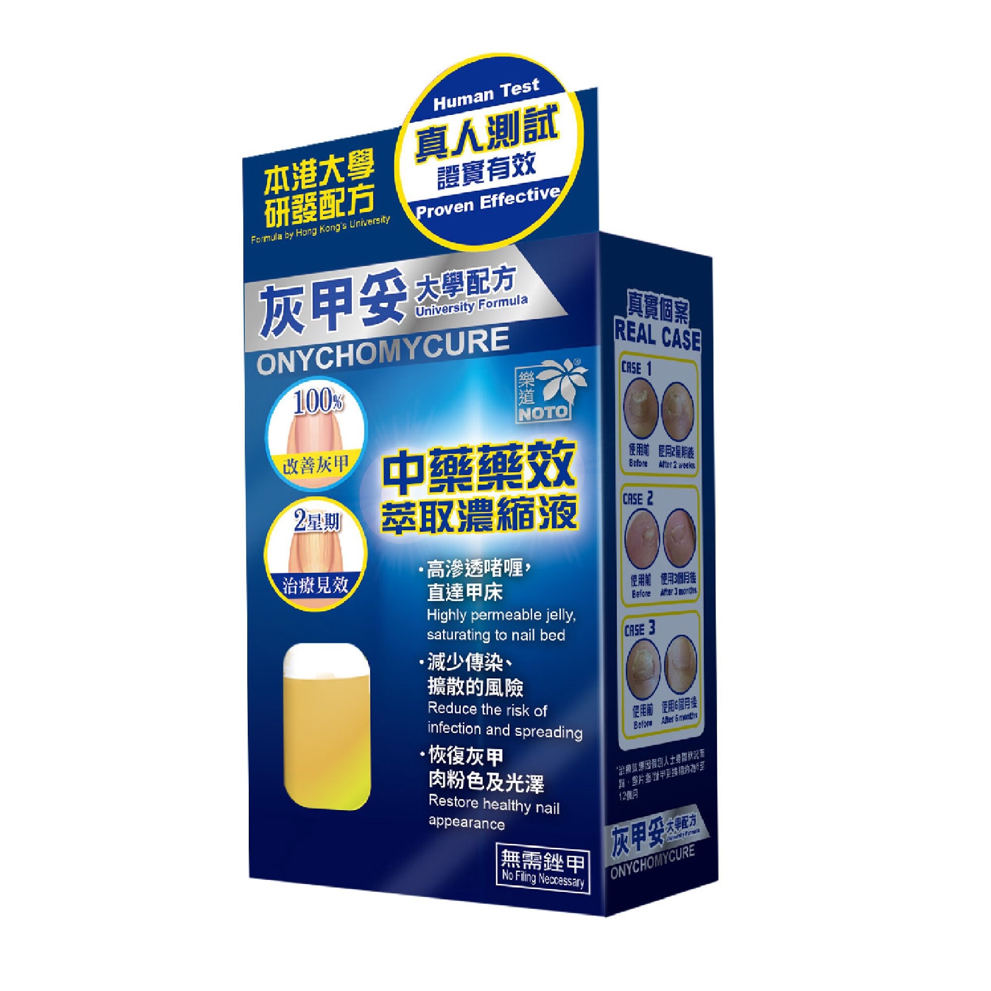  香港 樂道 乐道灰甲妥10ml安甲适灰甲液灰指甲修护液对各种皮肤癣菌有效保持健康的指甲外观