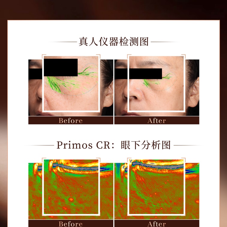 4D Pyramid Eye Beauty Mask 60sheets 4