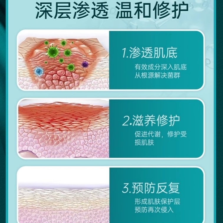 【中國直郵】 修正 外陰搔癢止癢膏男女性專用下面私處根抑菌去癢止癢乳膏 針對男女私處常見的細菌滋生、瘙癢、異味、潮濕,長效抑菌,同時舒緩不適,讓私處保持清爽潔淨 20g